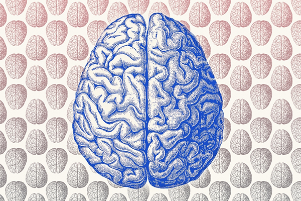 20150218171512-brain